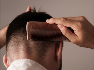 Hair Problem Evaluation and Diagnosis for Effective Treatment Solutions at M Aesthetics by Dr. Akshay Mirajkar, Expert in Hair Care and Dermatology in Baner Pune, Karad, and Satara