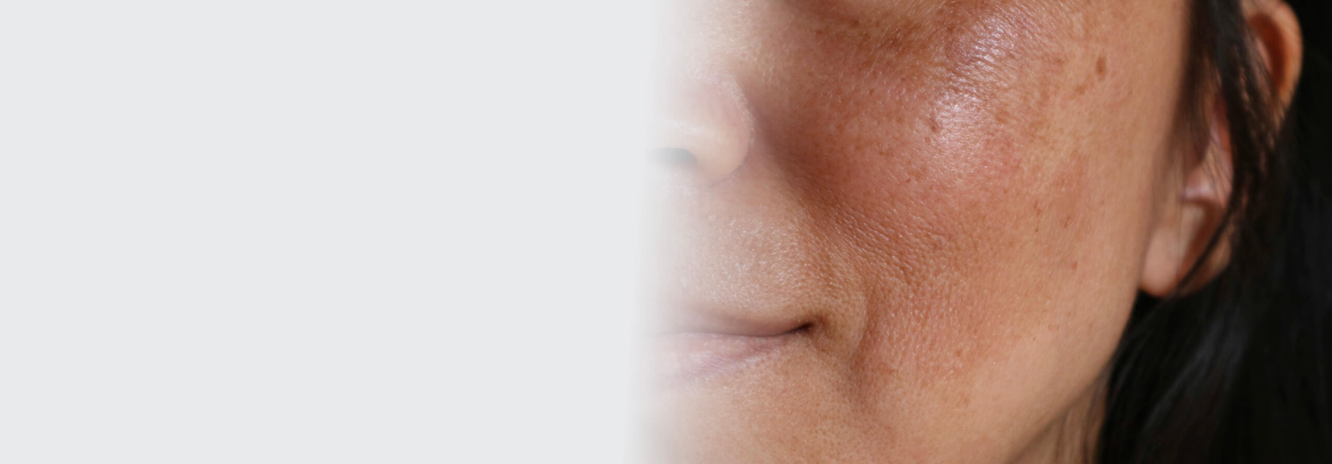 Expert Guide to Pigmentation Treatment – M-Aesthetics Skin & Hair Clinic, Baner